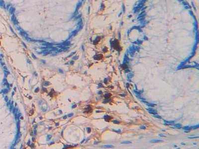 Monoclonal Antibody to Tryptase (TPS)