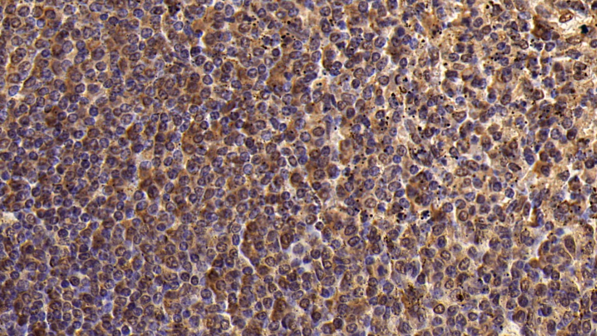 Monoclonal Antibody to Cluster Of Differentiation 4 (CD4)