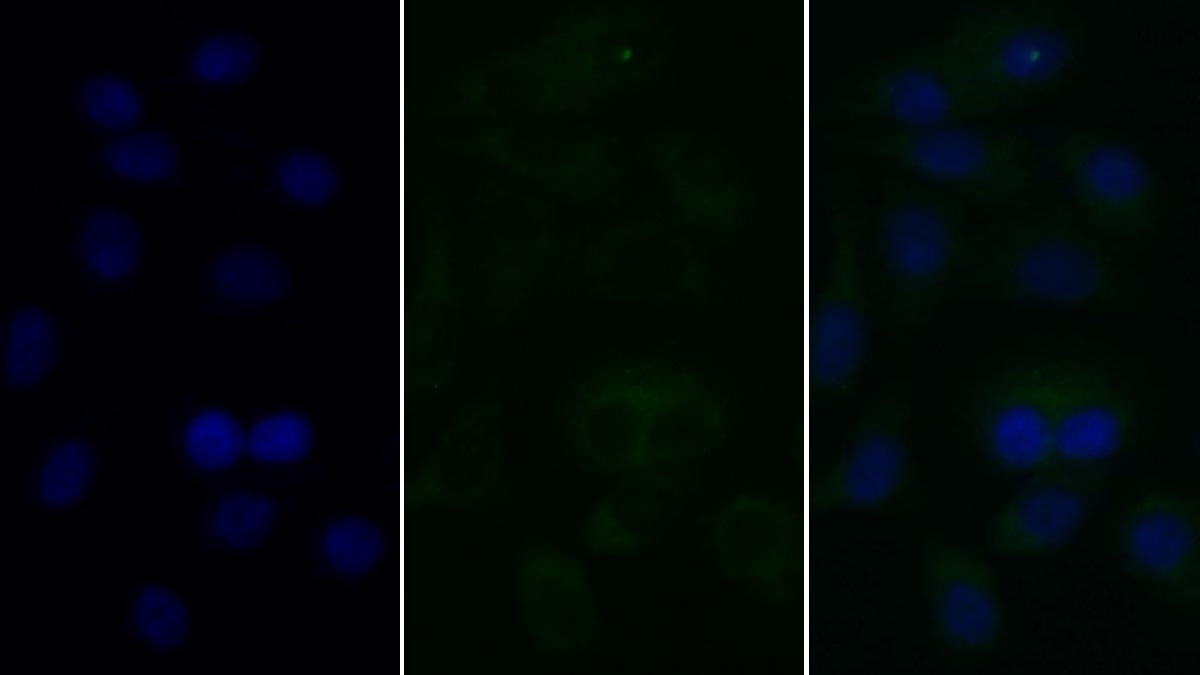 Monoclonal Antibody to Transferrin Receptor (TFR)