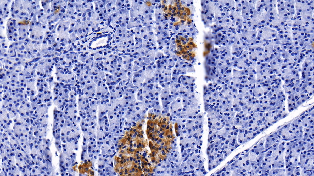 Monoclonal Antibody to Clusterin (CLU)