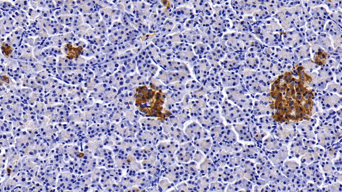 Monoclonal Antibody to Clusterin (CLU)