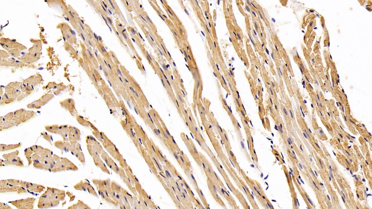 Monoclonal Antibody to Aspartate Aminotransferase (AST)