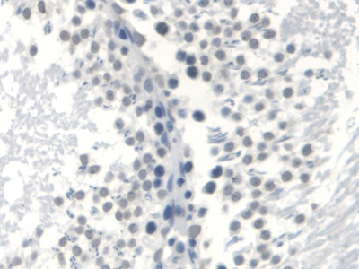 Monoclonal Antibody to Androgen Receptor (AR)