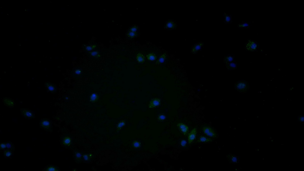 Monoclonal Antibody to Cathepsin D (CTSD)