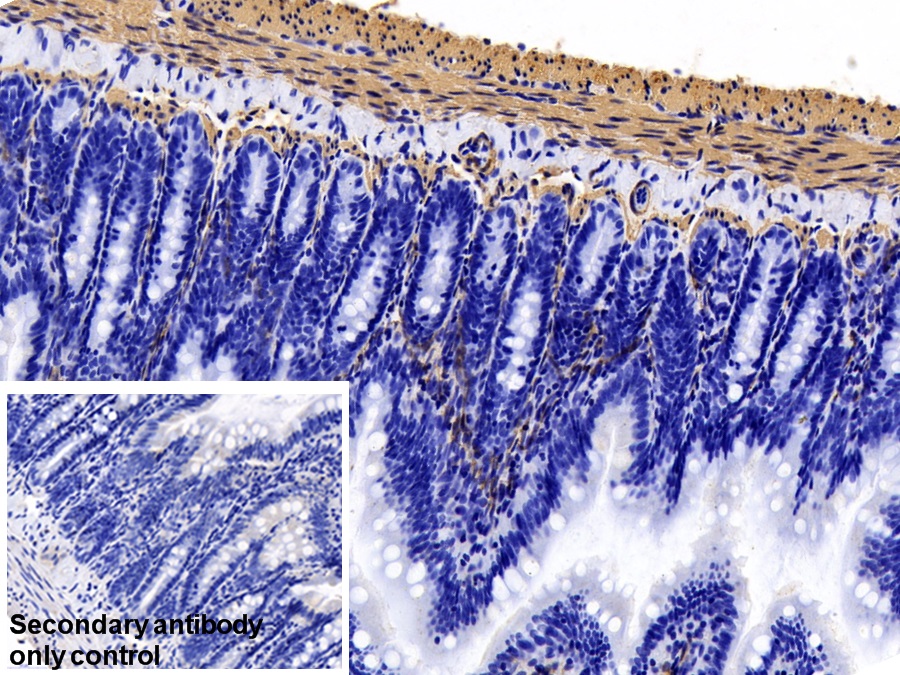 Monoclonal Antibody to Actin Alpha 1, Cardiac Muscle (ACTC1)