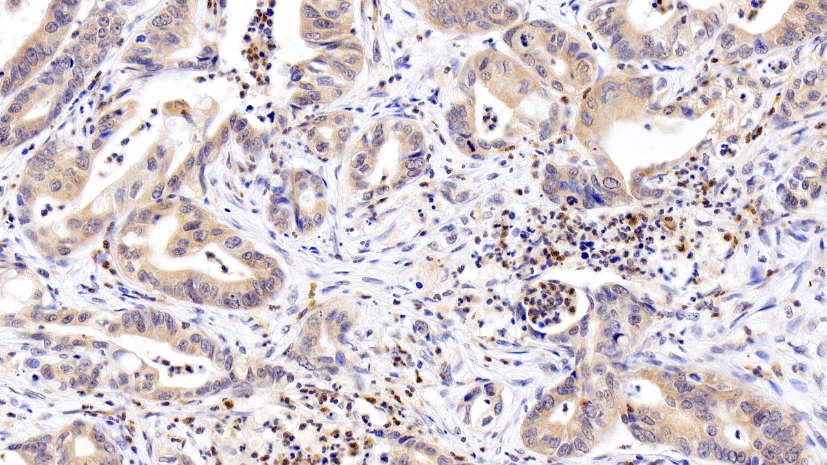 Monoclonal Antibody to Interferon Alpha/Beta Receptor 1 (IFNa/bR1)