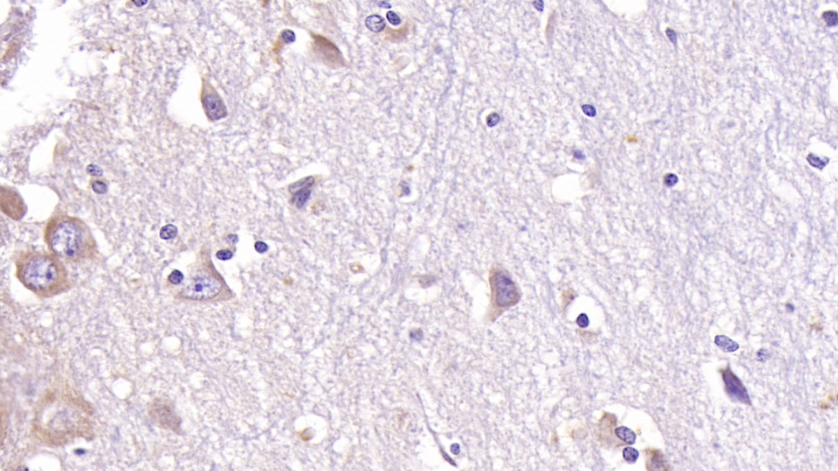 Monoclonal Antibody to Acetylcholinesterase (ACHE)