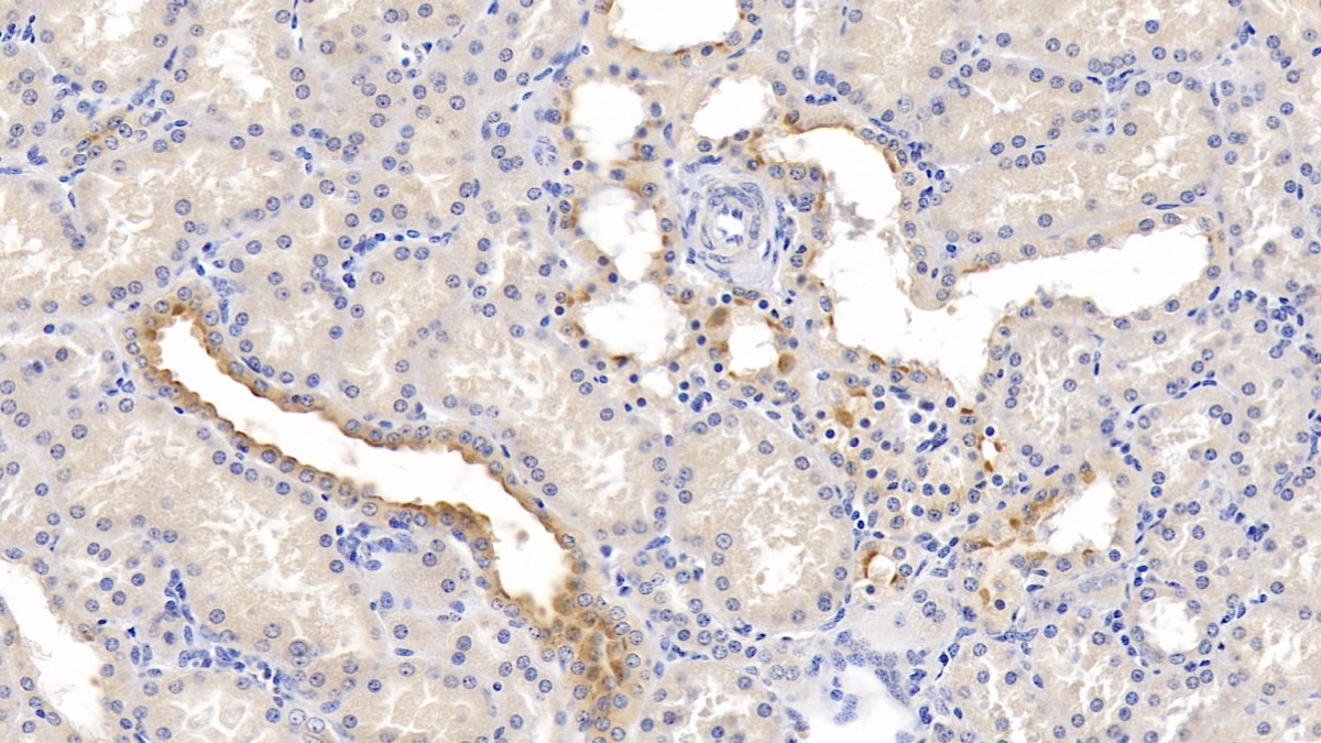 Monoclonal Antibody to Nectin 2 (NECTIN2)