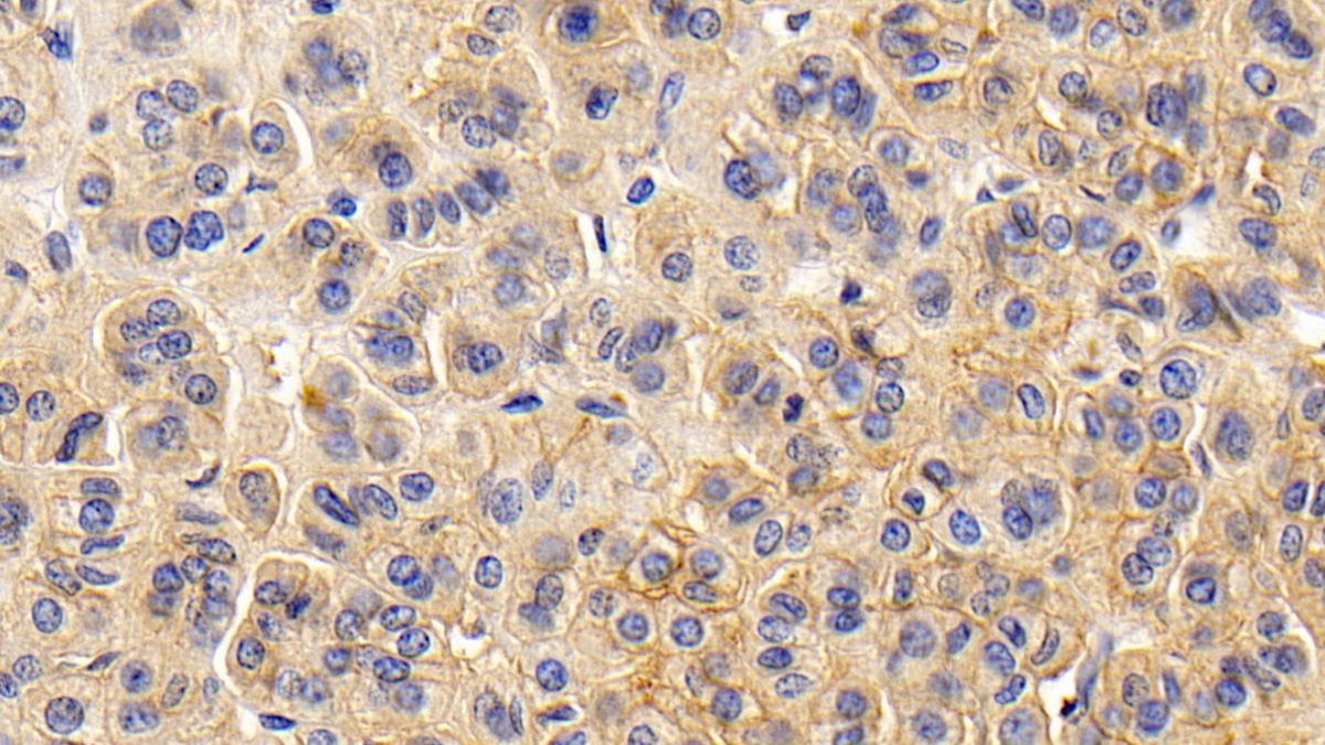 Monoclonal Antibody to Cluster Of Differentiation 147 (CD147)