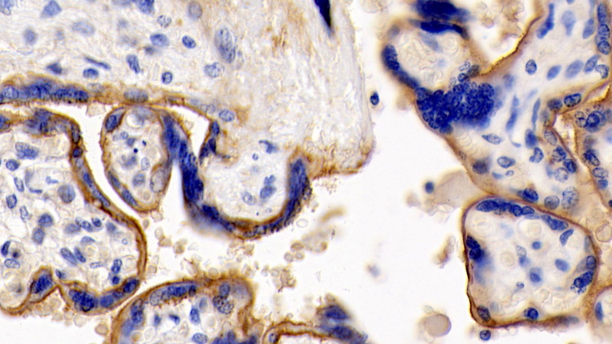 Monoclonal Antibody to Cluster Of Differentiation 147 (CD147)