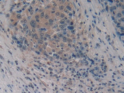 Monoclonal Antibody to Myostatin (MSTN)