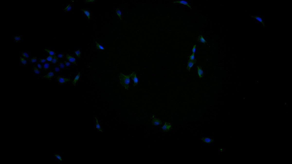 Monoclonal Antibody to Insulin Like Growth Factor 1 Receptor (IGF1R)