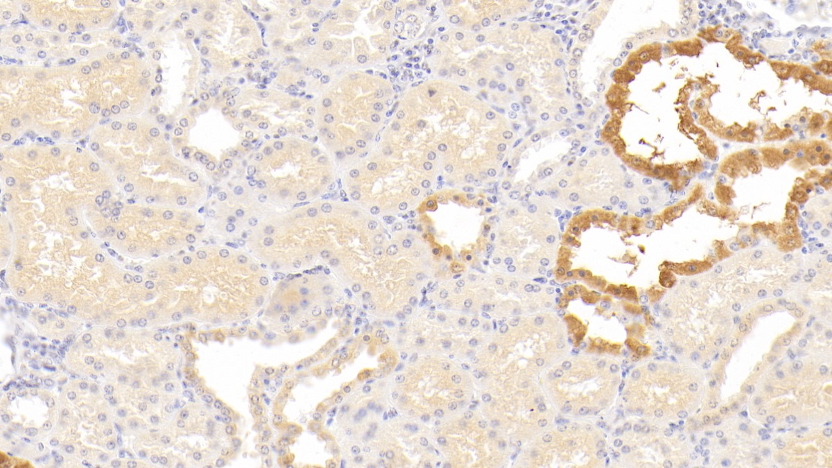 Monoclonal Antibody to Alpha-1-Antitrypsin (a1AT)