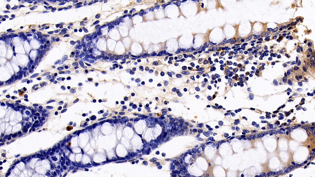 Monoclonal Antibody to Sialic Acid Binding Ig Like Lectin 7 (SIGLEC7)