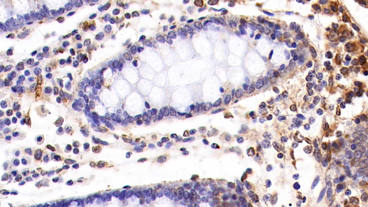 Monoclonal Antibody to Cluster Of Differentiation 5 (CD5)