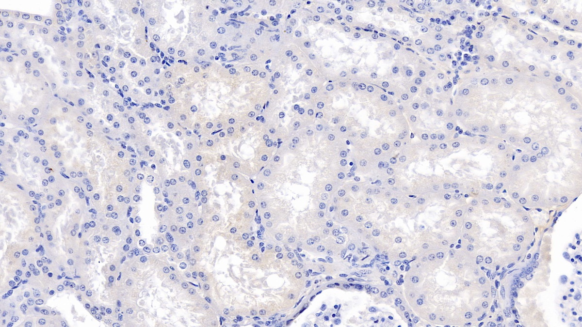 Monoclonal Antibody to Vitamin D Binding Protein (DBP)