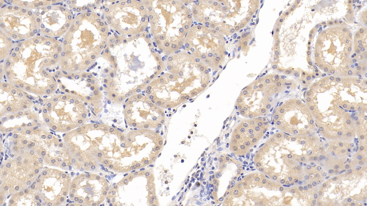 Monoclonal Antibody to Squamous Cell Carcinoma Antigen 1/2 (SCCA1/SCCA2)