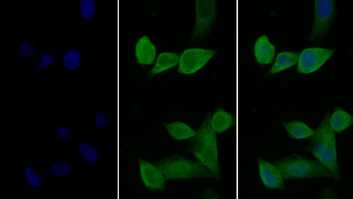 Monoclonal Antibody to Interleukin 2 Receptor Alpha (IL2Ra)