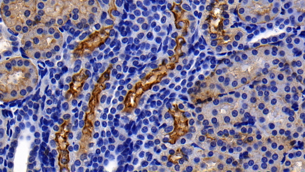 Monoclonal Antibody to Angiotensin I Converting Enzyme 2 (ACE2)