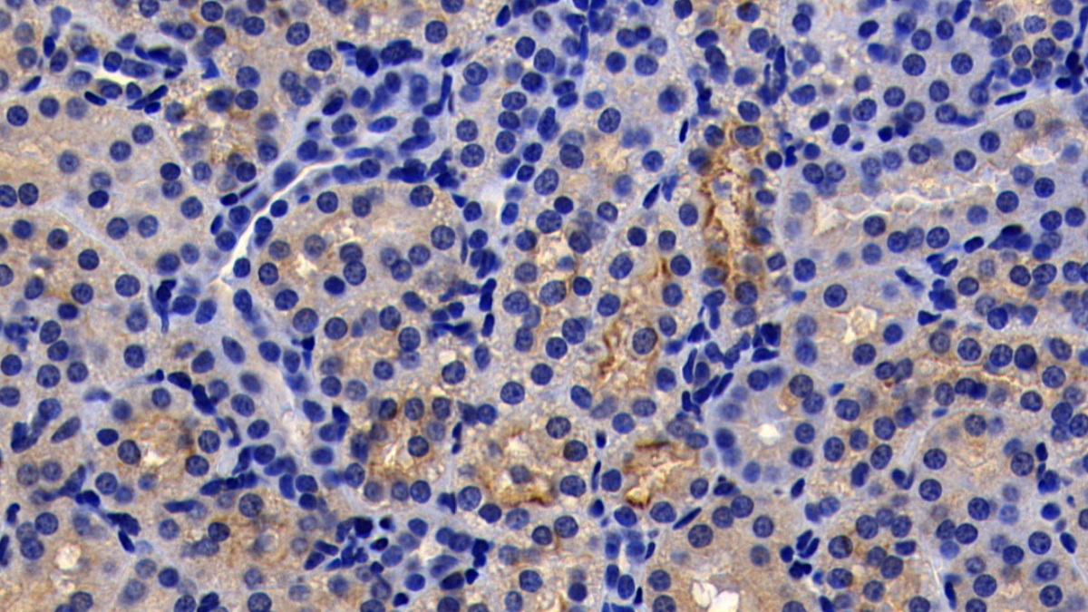 Monoclonal Antibody to Angiotensin I Converting Enzyme 2 (ACE2)