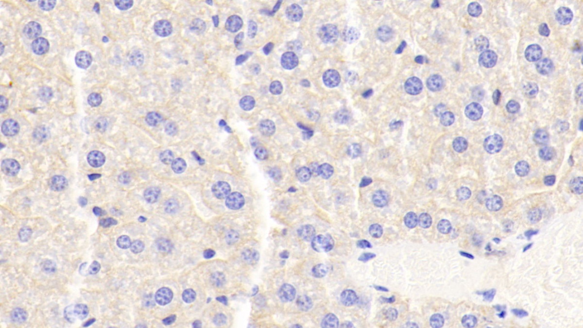 Monoclonal Antibody to Apolipoprotein C3 (APOC3)