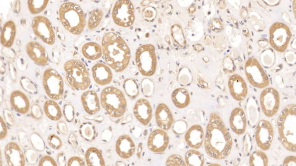 Monoclonal Antibody to Syndecan 1 (SDC1)