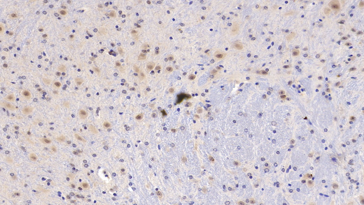 Monoclonal Antibody to Pigment Epithelium Derived Factor (PEDF)