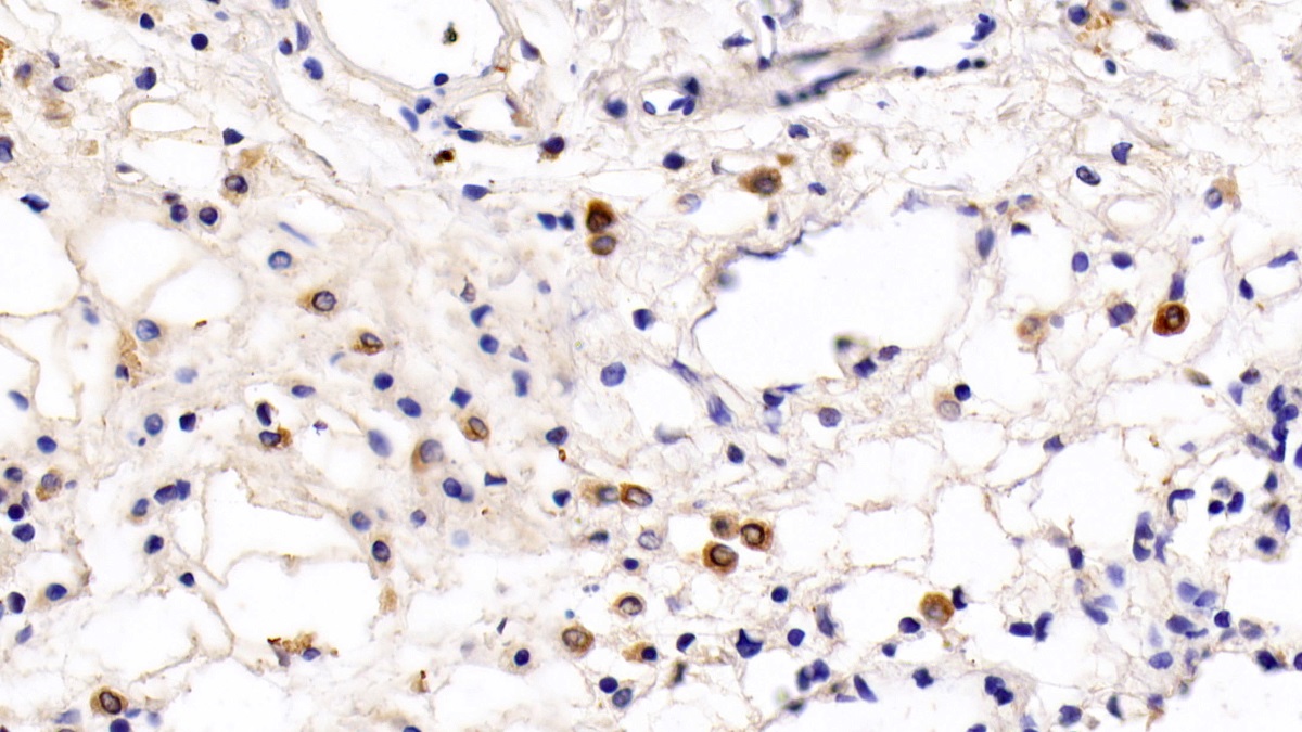 Monoclonal Antibody to Toll Like Receptor 5 (TLR5)