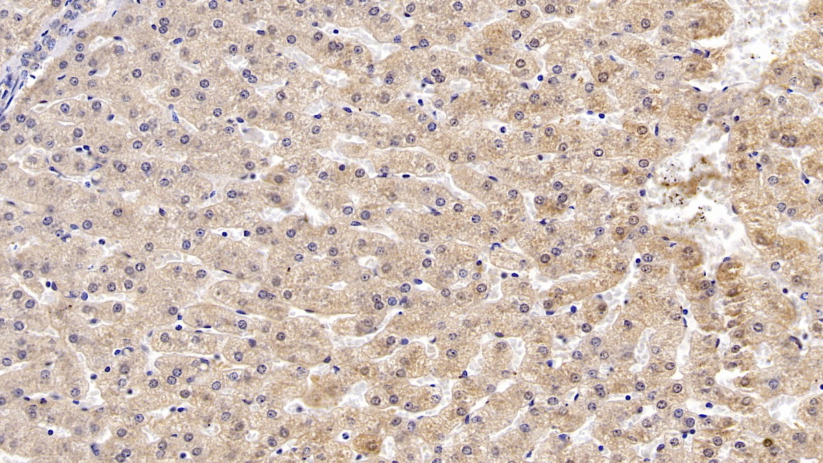 Monoclonal Antibody to Apolipoprotein B (APOB)