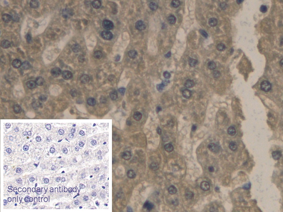 Monoclonal Antibody to Apolipoprotein B (APOB)