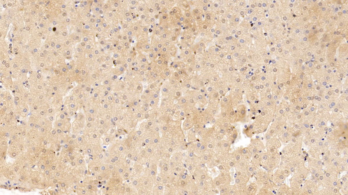 Monoclonal Antibody to Serpin A10 (SERPINA10)