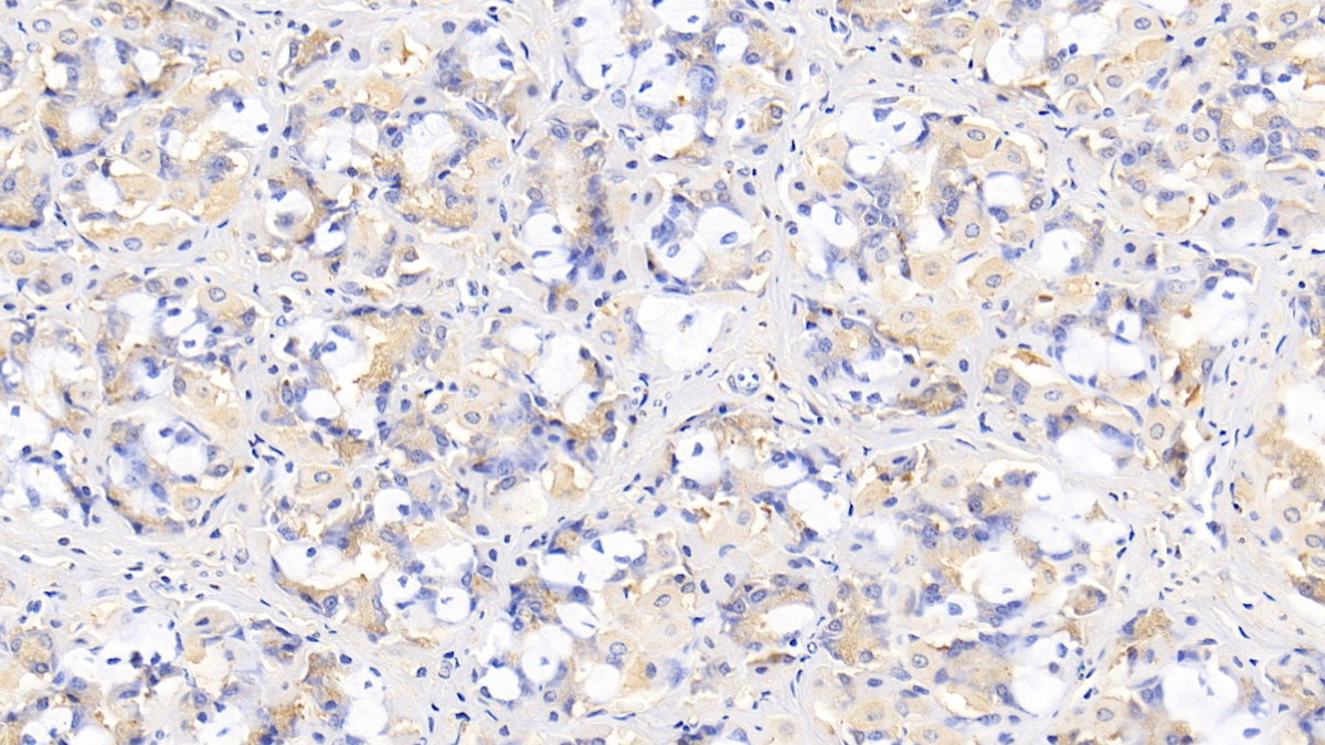Monoclonal Antibody to Interleukin 29 (IL29)