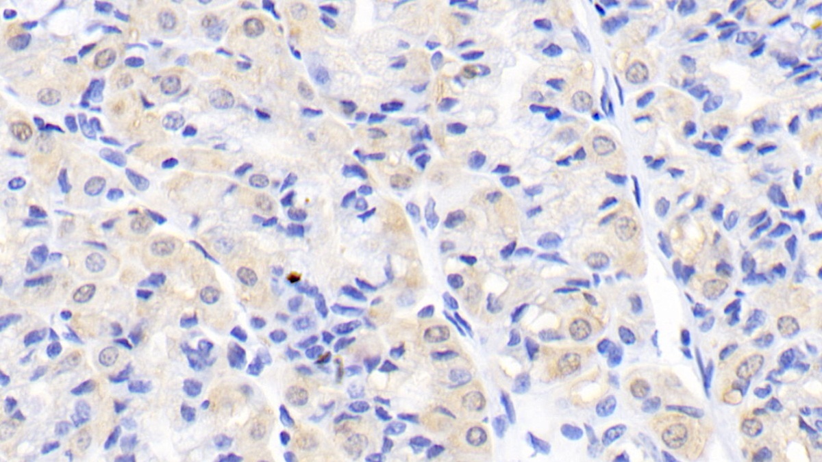 Monoclonal Antibody to Creatine Kinase B (CK-BB)