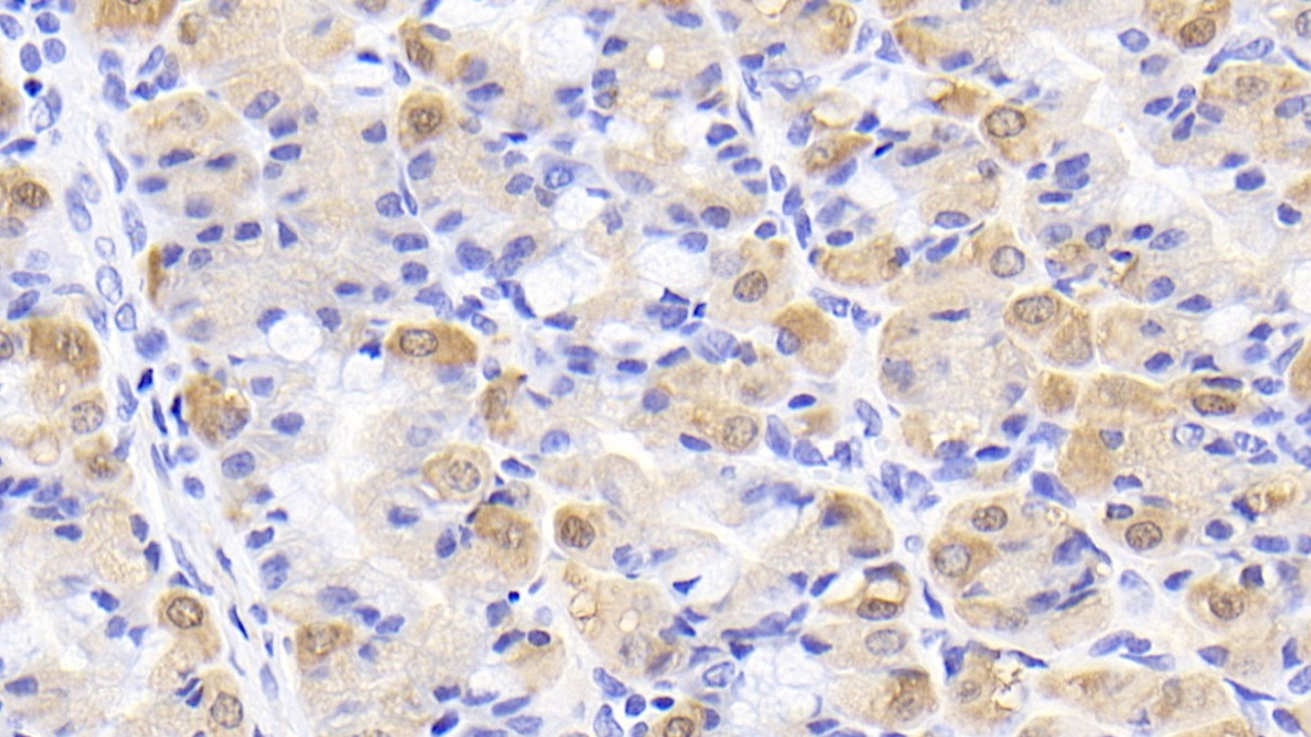 Monoclonal Antibody to Creatine Kinase B (CK-BB)