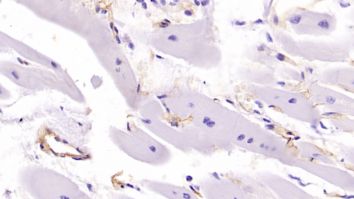 Monoclonal Antibody to Major Histocompatibility Complex Class I C (MHCC)