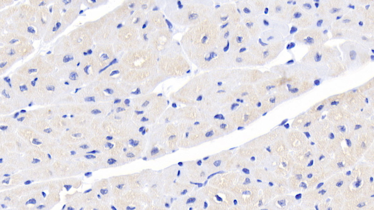 Monoclonal Antibody to Activin A Receptor Type II A (ACVR2A)