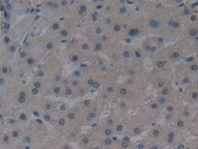 Monoclonal Antibody to Noggin (NOG)