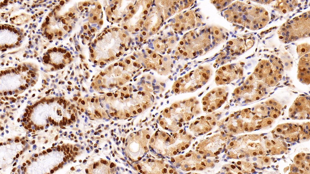 Monoclonal Antibody to Histone Deacetylase 1 (HDAC1)