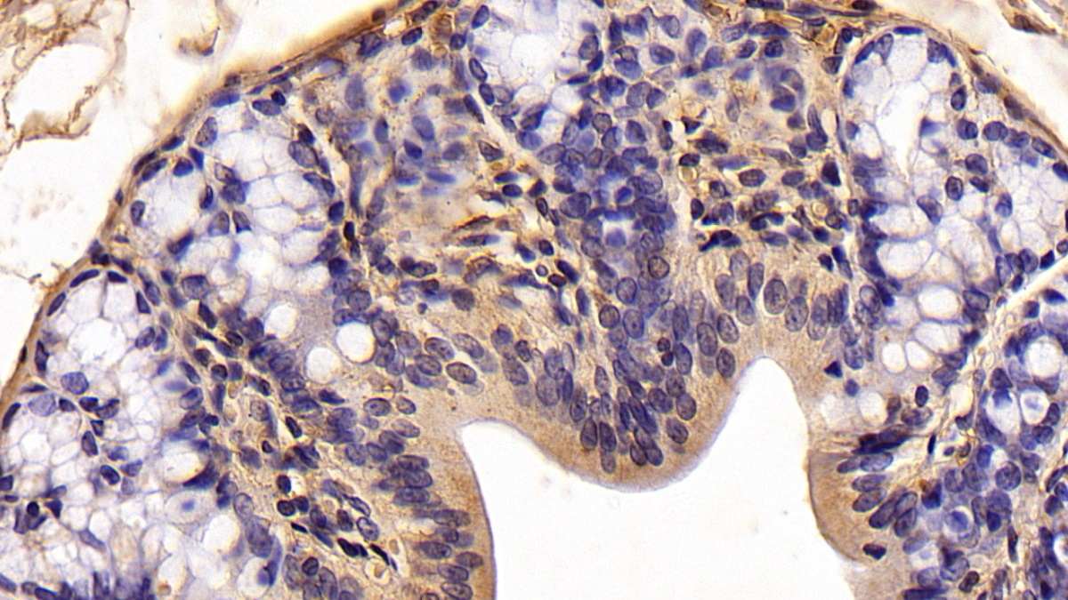 Monoclonal Antibody to Anterior Gradient 2 (AGR2)