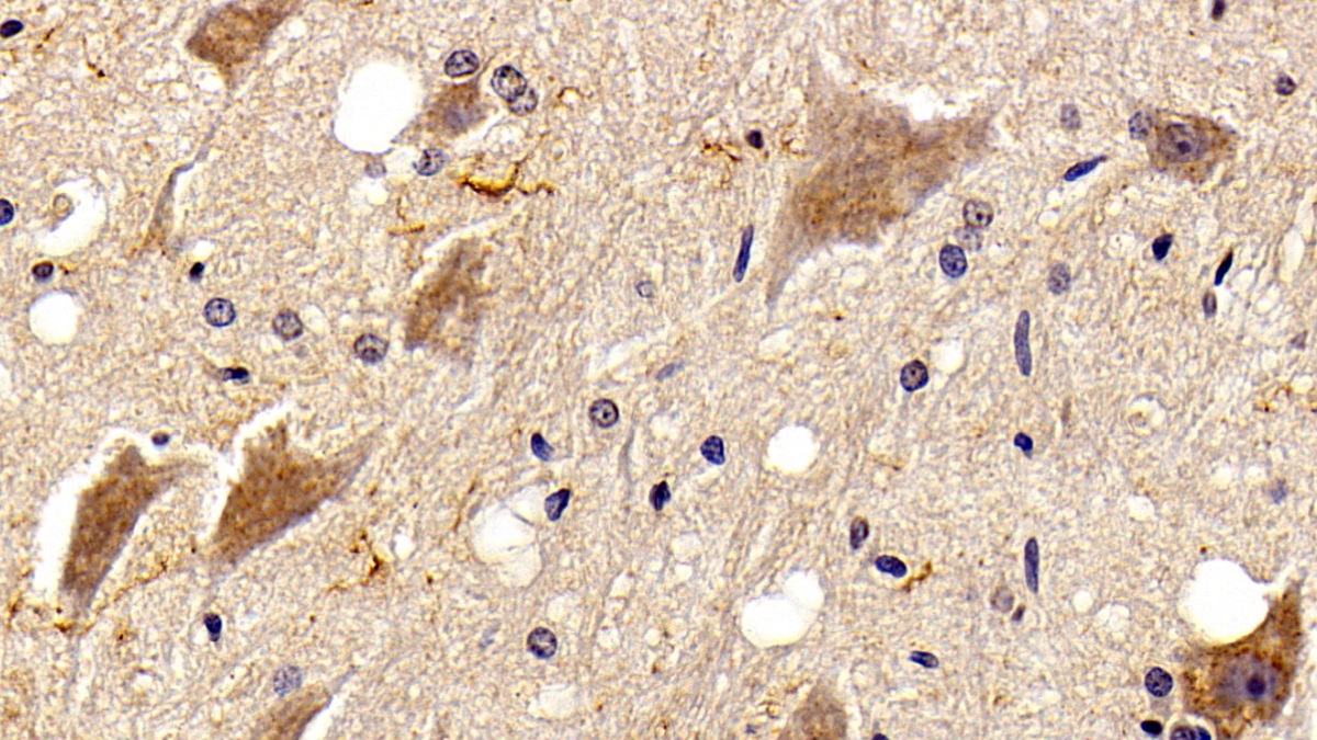 Monoclonal Antibody to Allograft inflammatory factor 1 (AIF1)