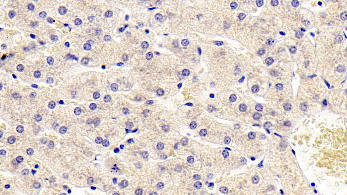 Monoclonal Antibody to Antithrombin (AT)