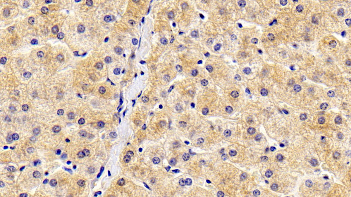 Monoclonal Antibody to Antithrombin (AT)