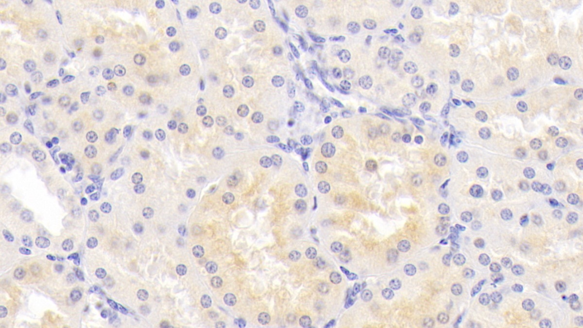 Monoclonal Antibody to Histidine Rich Glycoprotein (HRG)