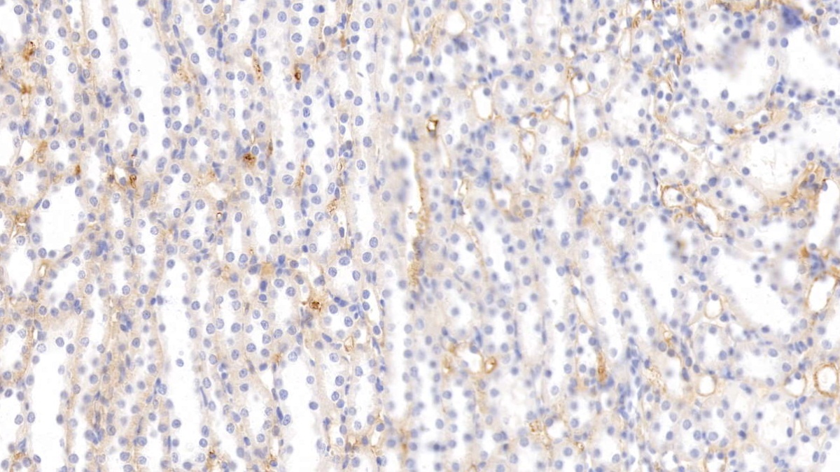 Monoclonal Antibody to Histidine Rich Glycoprotein (HRG)