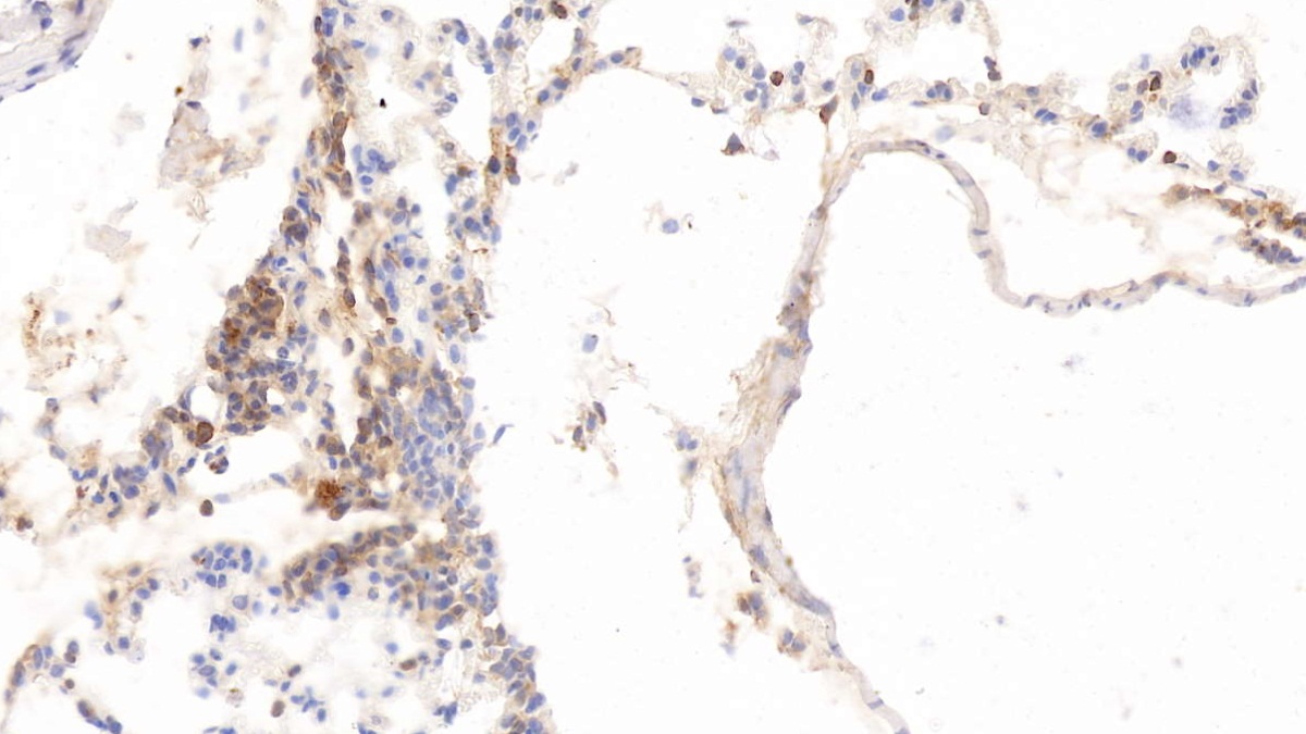 Monoclonal Antibody to Histidine Rich Glycoprotein (HRG)