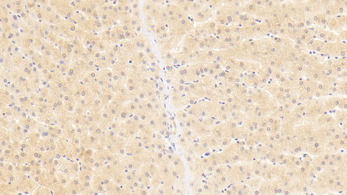 Monoclonal Antibody to 2',5'-Oligoadenylate Synthetase 1 (OAS1)