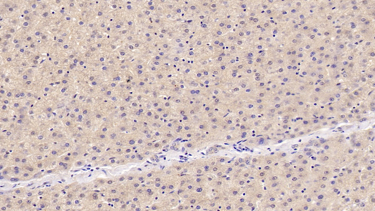 Monoclonal Antibody to 2',5'-Oligoadenylate Synthetase 1 (OAS1)