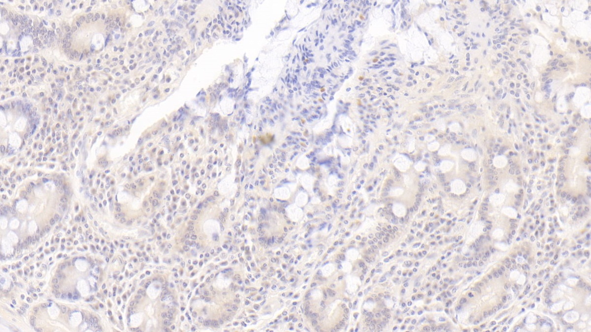 Monoclonal Antibody to 2',5'-Oligoadenylate Synthetase 1 (OAS1)