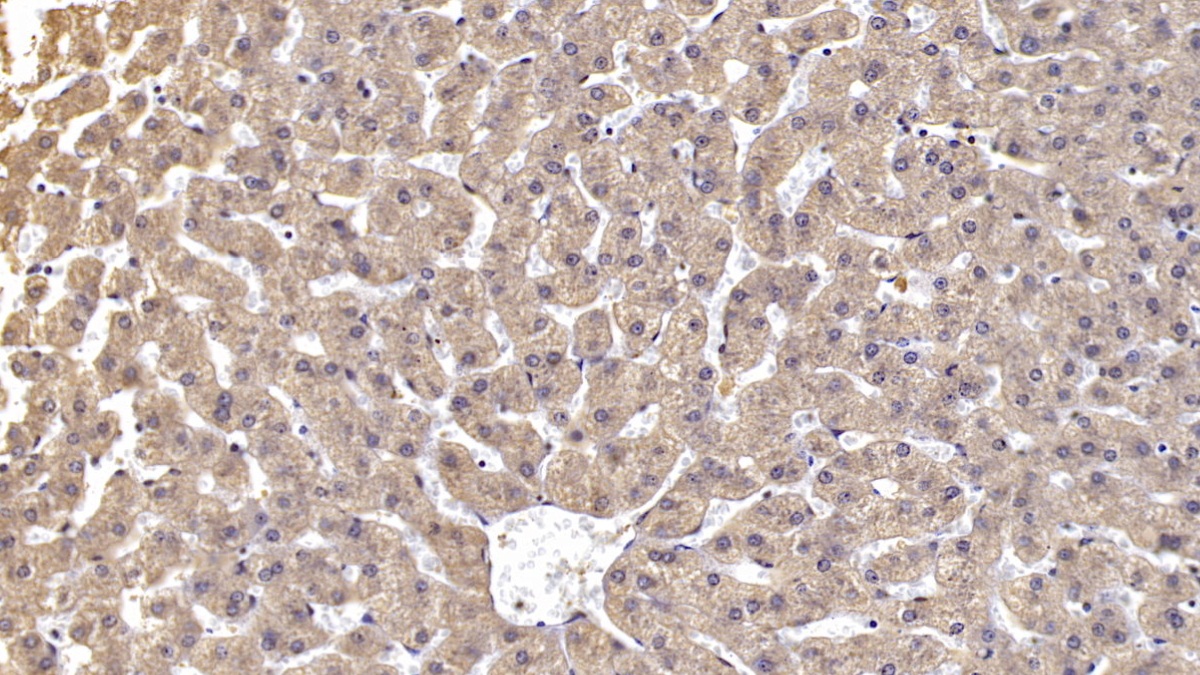 Monoclonal Antibody to Reelin (RELN)