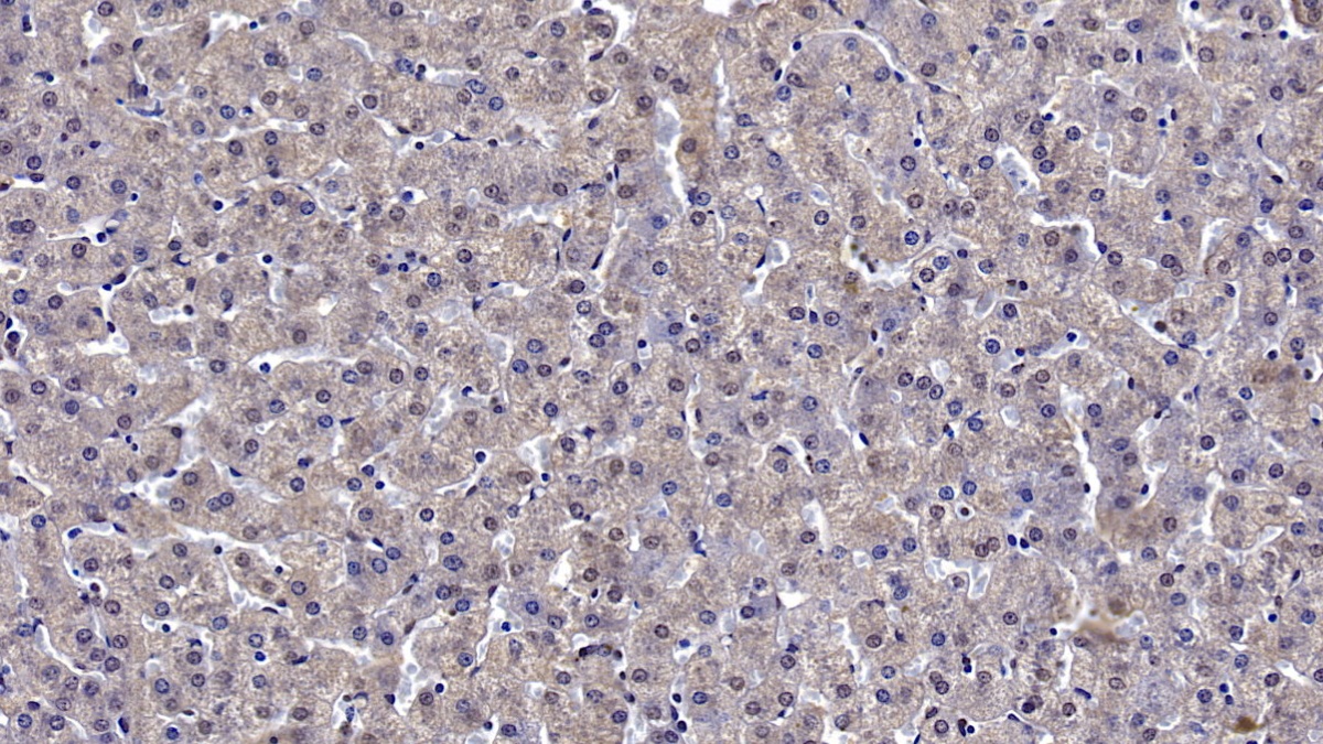 Monoclonal Antibody to Reelin (RELN)